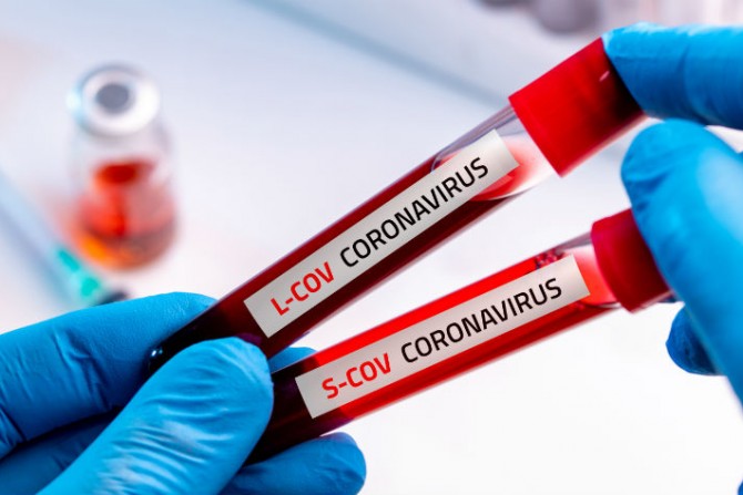 коронавірусна інфекція - 9400d112-ce89-4f5c-bd3a-3268992f2d55 - зображення