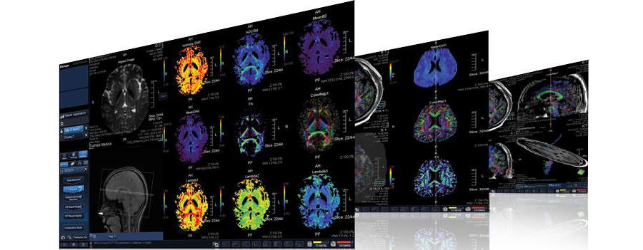 Безопасно ли делать МРТ головного мозга? - зображення
