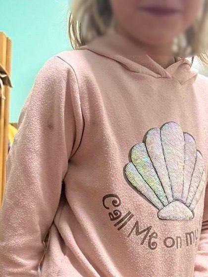 Нелюдська жорстокість: на Фастівщині вихователька катувала 9-річну дівчинку - зображення