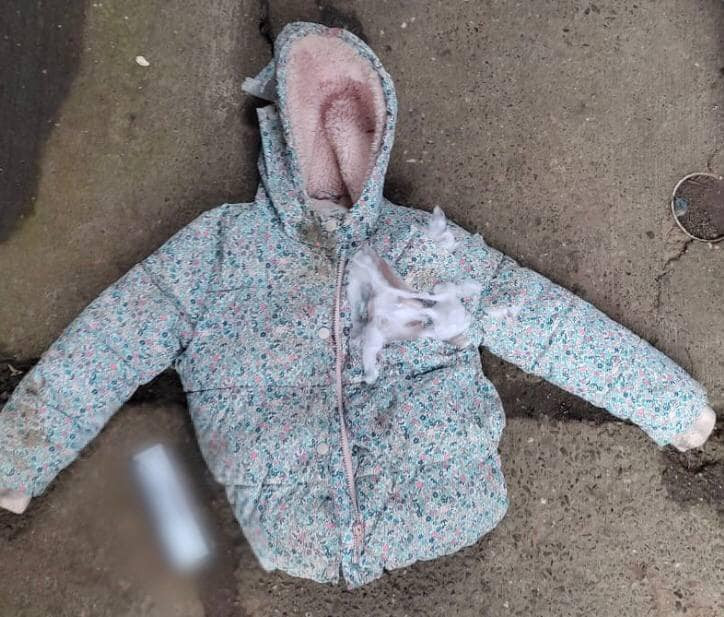 На Київщині собаки покусали матір з 7-річною донькою - зображення
