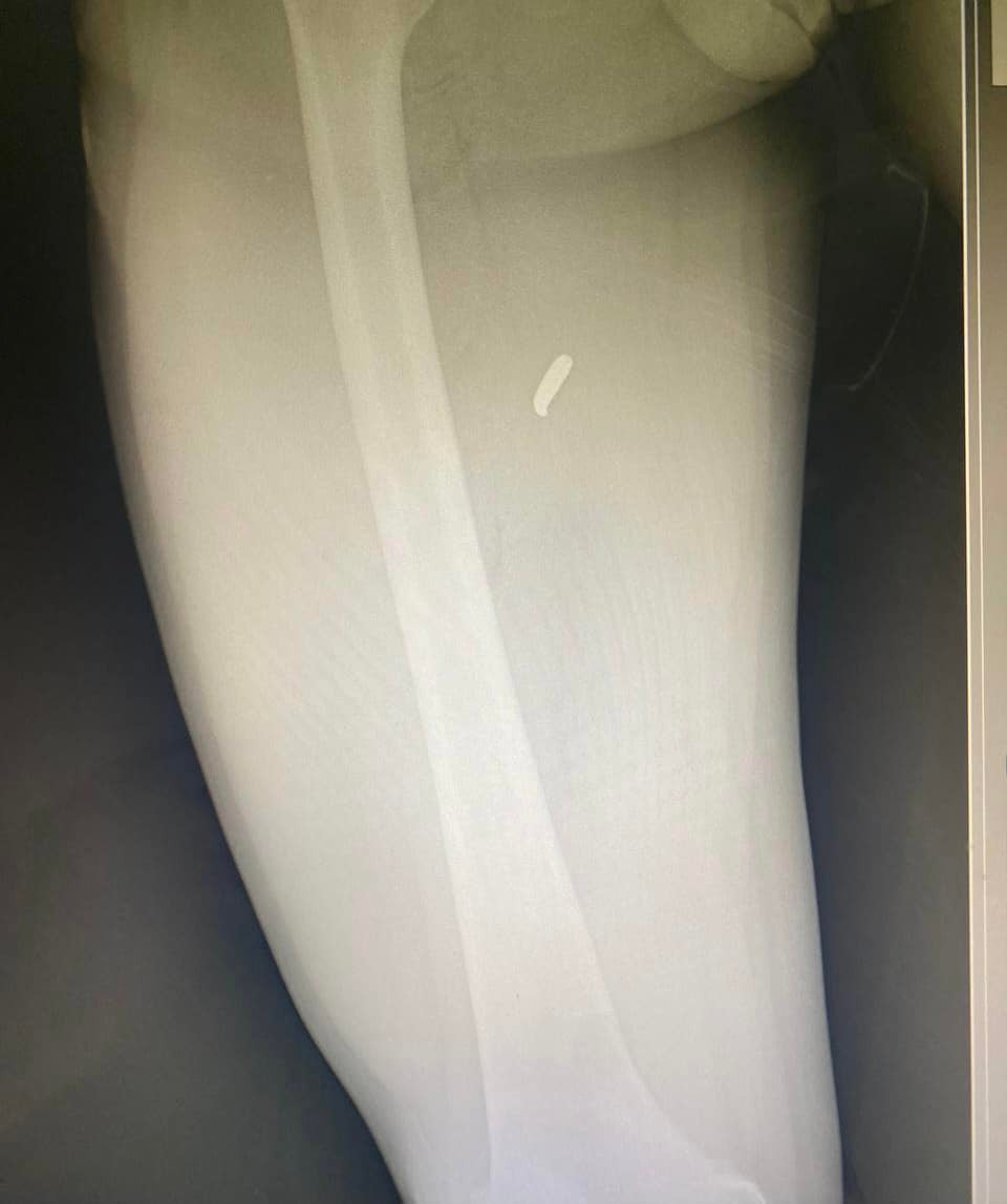 Севгіль Мусаєва: 13 березня - День, коли час зупинився - 2 - зображення